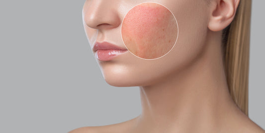Soft Tissue Biopsy