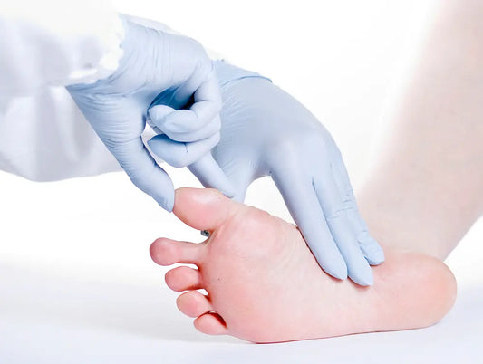 Risk for Your feet What is Oedema
