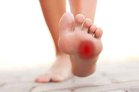 Morton’s Neuroma: everything you didn’t know