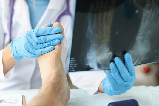 HOW DOES RHEUMATOID ARTHRITIS AFFECT LEG HEALTH?