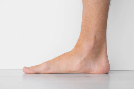 DO YOU HAVE ANY OF THESE SYMPTOMS? IT IS ABOUT FLAT FEET…