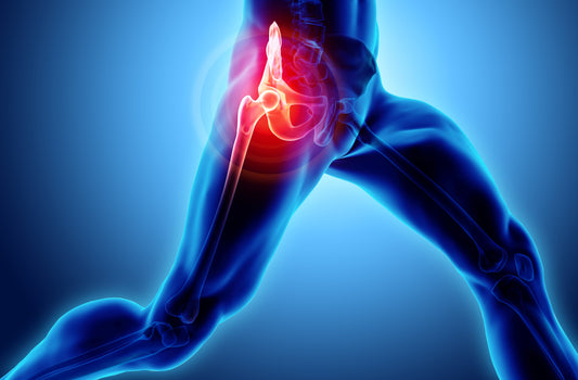 Your Guide to Total Hip Replacement Surgery