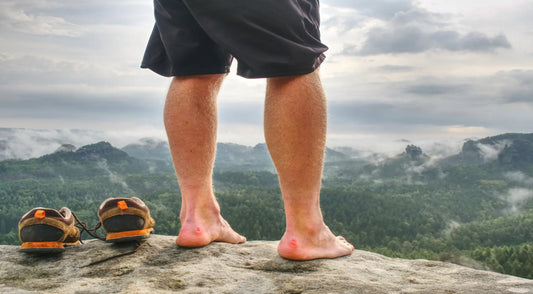 Blister Treatment and Prevention
