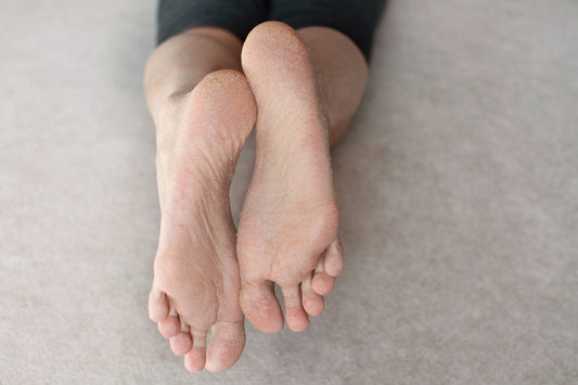 Dry skin on legs
