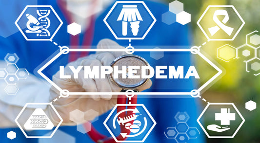 Lymphedema: What Is It?