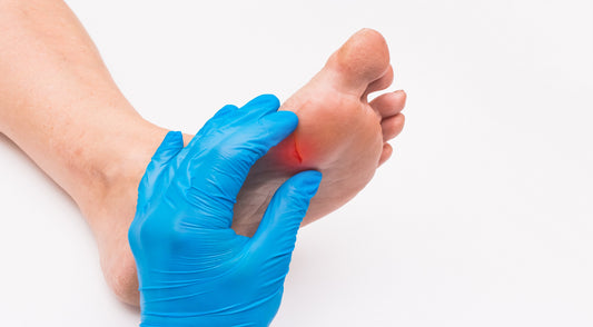 “Cutting” into Foot Health: Understanding the Risks and Prevention of Cuts and Wounds on the Feet