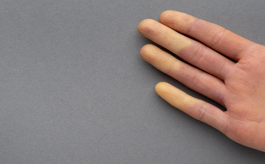 Raynaud's Disease: What is it?