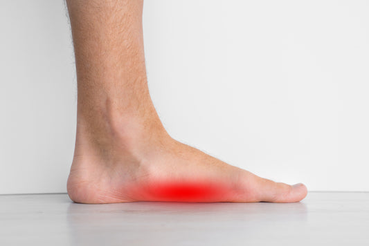 Flat Feet: What Are They?