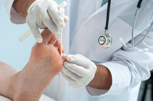 Athlete’s Foot in winter is common, and here’s 4 ways to prevent It!