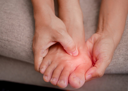 What Are Bunions?