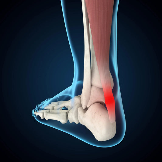 Common Foot Injuries in Sports