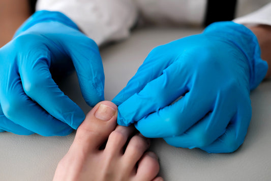 Is It Psoriatic Arthritis or Lupus