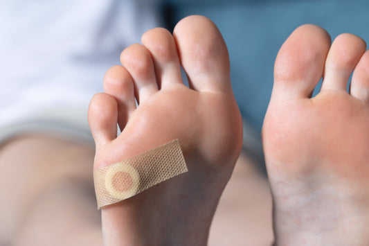 How to treat Plantar Warts naturally