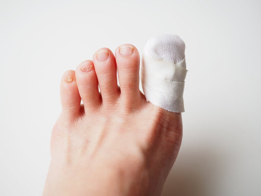 Treatment for a Cracked Toenail