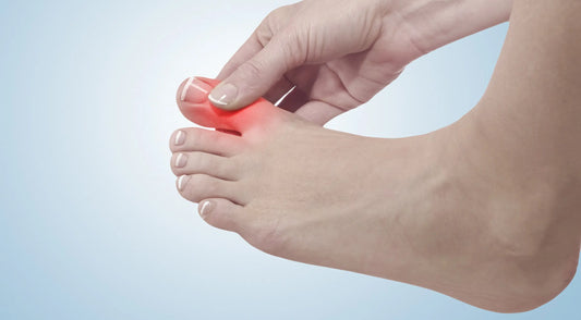 Why is the Skin Around My Toenail Red Understanding the Causes and Treatment Options