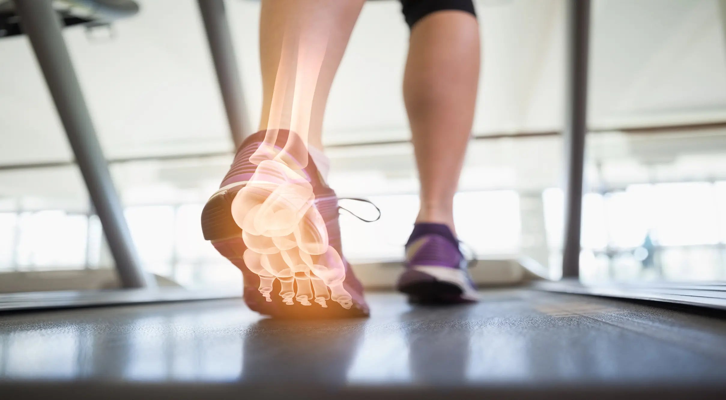 Posterior Heel Pain – drluigi