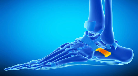 Peroneal Tendonitis