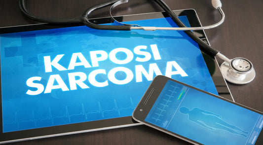 Kaposi Sarcoma